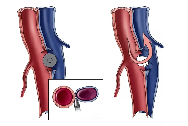 Vascular Trauma Surgery